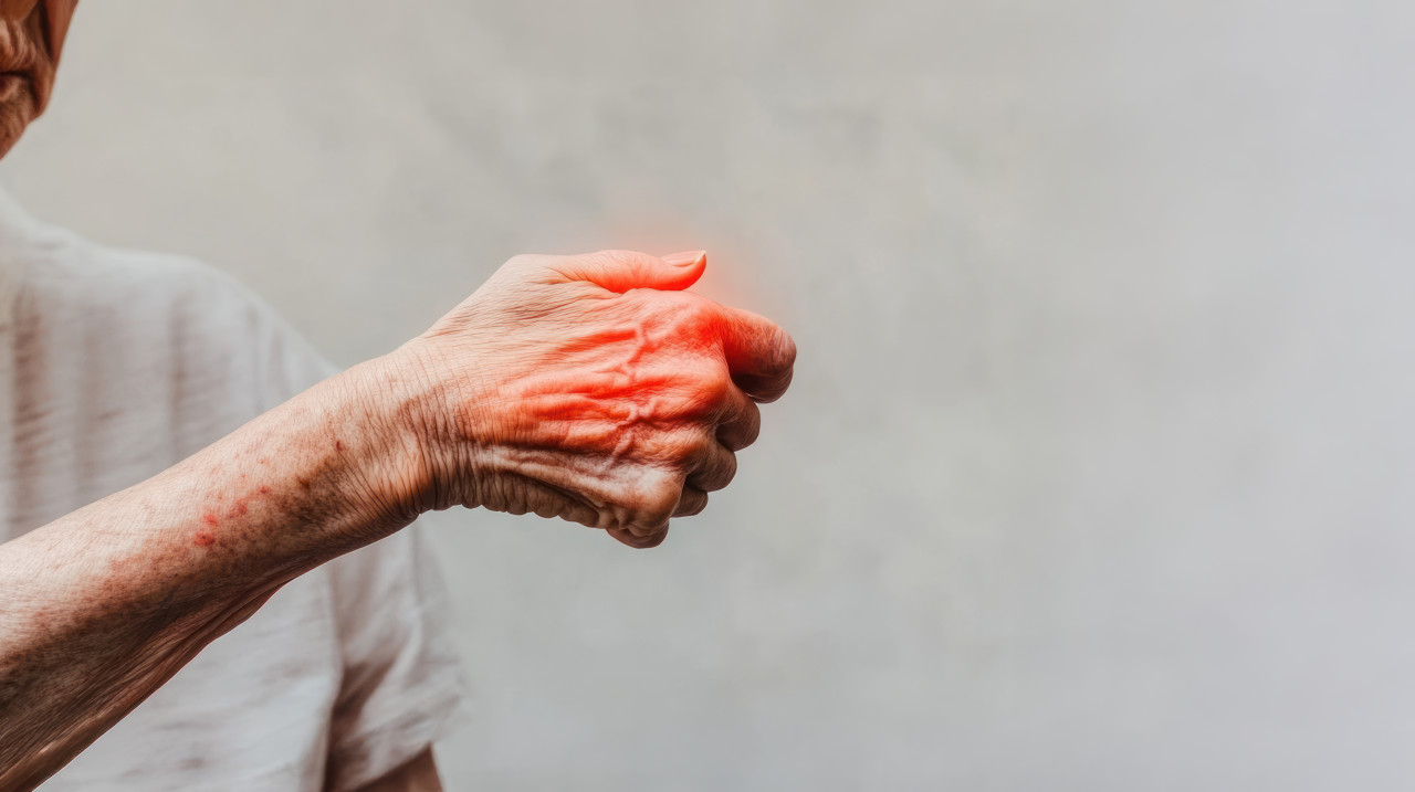 A person with redness and pain in the back of their arm shows signs of joint discomfort, geriatric pt highlights care techniques using geriatric therapy icons for recovery